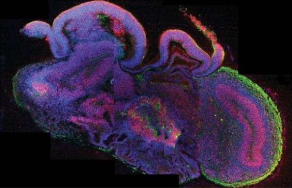 Mini Human Brains Created With Stem Cells