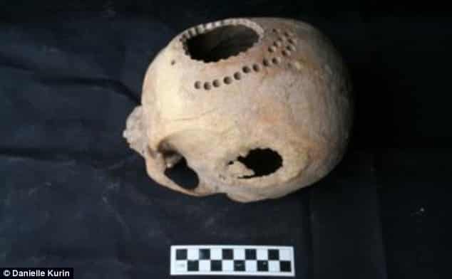 1,000-year-old Skull