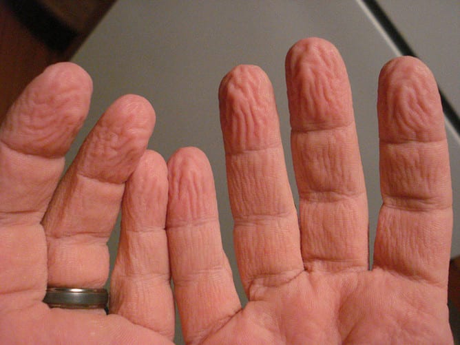 Wrinkled finger skin