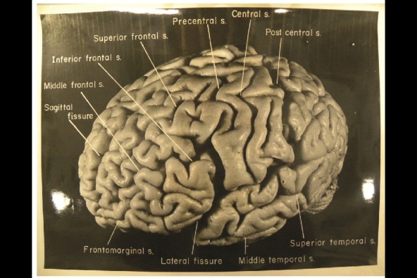 Einstein's Brain, Image - 1