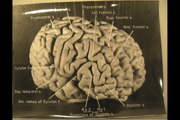 Einstein's Brain, Image-2