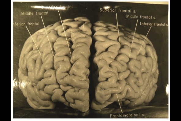 Einstein's Brain, Image-3