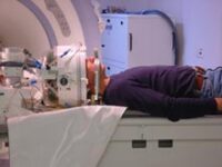 Ultrasound Beams Could Be Use To Prevent Stroke