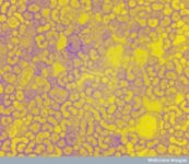 Scientists Make Huge Leap Toward Finding A Cure For Common Cold And Other Flu