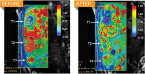 A New Protein Killer Could Be The Much Sought-After Cure For Cancer