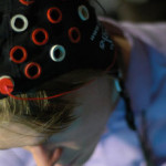 Visual Memory Can Be Improved 110 Percent By Electrical Stimulation To The Brain