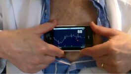 iPhonECG Case Turns iPhone 4 into an ECG machine [Video]