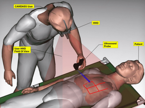 Read more about the article Be A Temporary Surgeon With ‘CAMDASS’ Device
