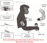 Researchers Create Brain-implanted Electrical Device That Helps To Restore Paralyzed Limbs