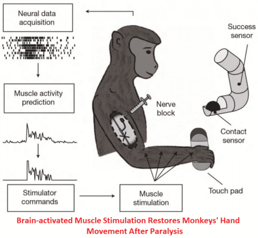 Read more about the article Researchers Create Brain-implanted Electrical Device That Helps To Restore Paralyzed Limbs