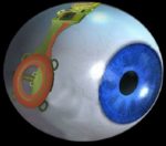 Bionic Eye Implant To Give Vision Back To The Blinds