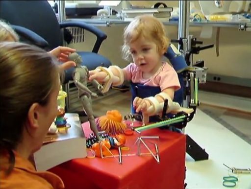 Read more about the article 3D Printed “Exoskeleton” Helps A Two Year Old Girl Overcome Congenital Disorders