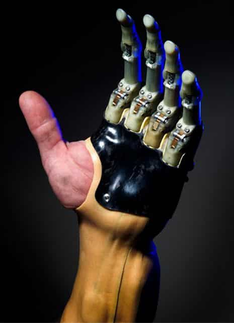 Read more about the article Touch Bionics Announced To Release New Prosthetic Fingers Technology