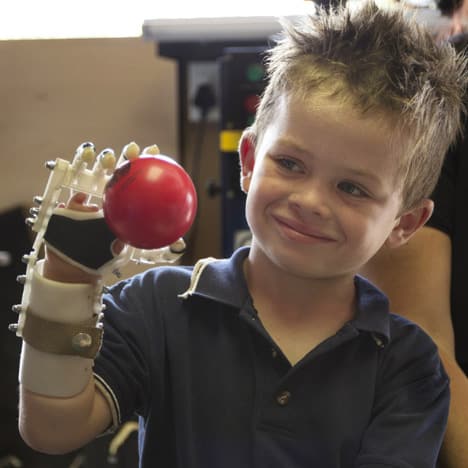 Read more about the article 3D-Printed Robohands That Help Kids Without Fingers