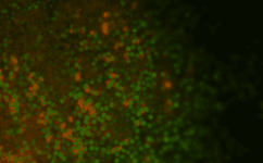 Scientists Convert Human Stem Cells Into Functional Lung Cells