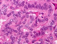 Trip To Outer Space Slows Down The Growth Of Cancer Cells