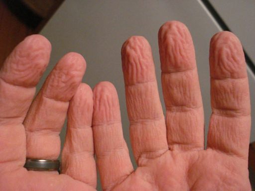 Read more about the article Why Do Our Fingers Appear Wrinkled When We Keep Them Wet For Few Minutes?