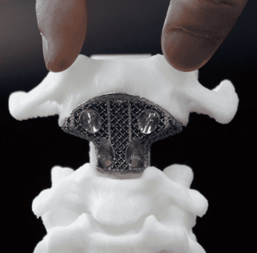 Read more about the article Beijing Hospital Performs World’s First 3D Printed Vertebra Surgery