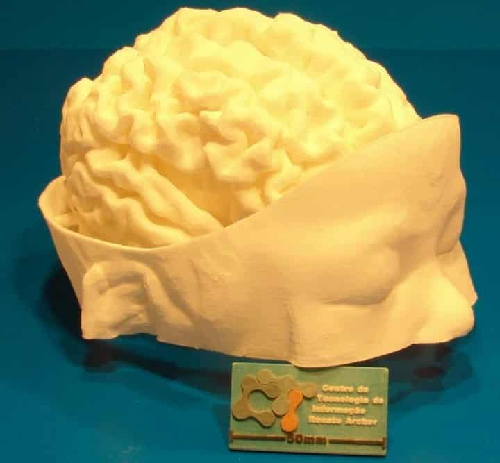 You are currently viewing Neurosurgeons May Use 3D-Printed Brain Replicas To Save Children In Near Future