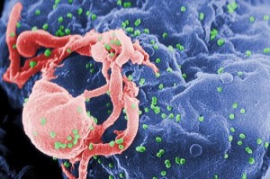 Read more about the article Big Step Ahead in Quest for HIV Vaccine
